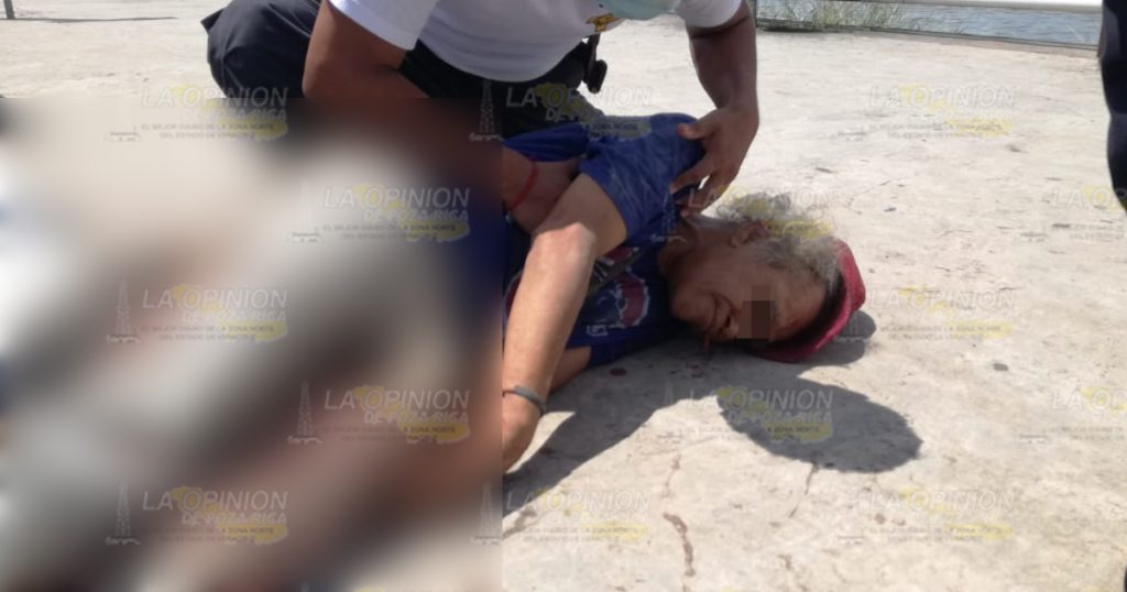 ¡Payaso apuñalado!