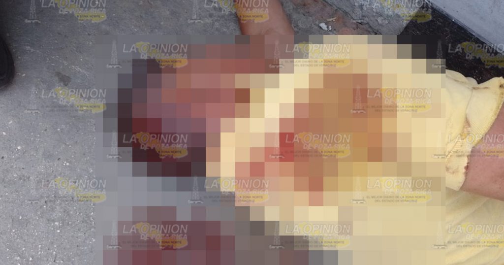 Ebrio cae y se abre la cabeza