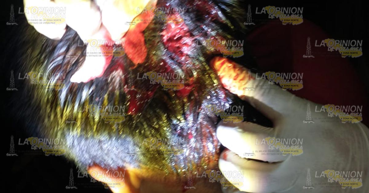 Joven derrapa en su motocicleta