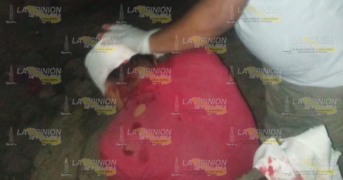 Joven derrapa en su motocicleta