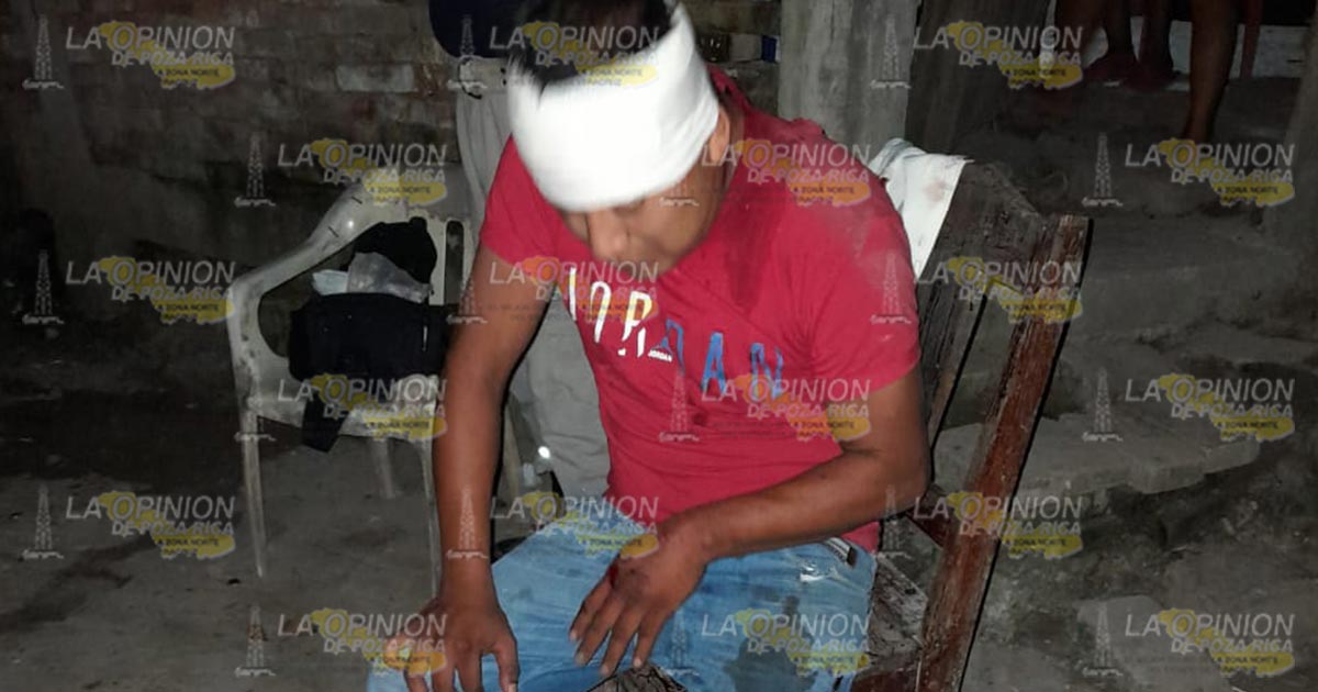 Joven derrapa en su motocicleta