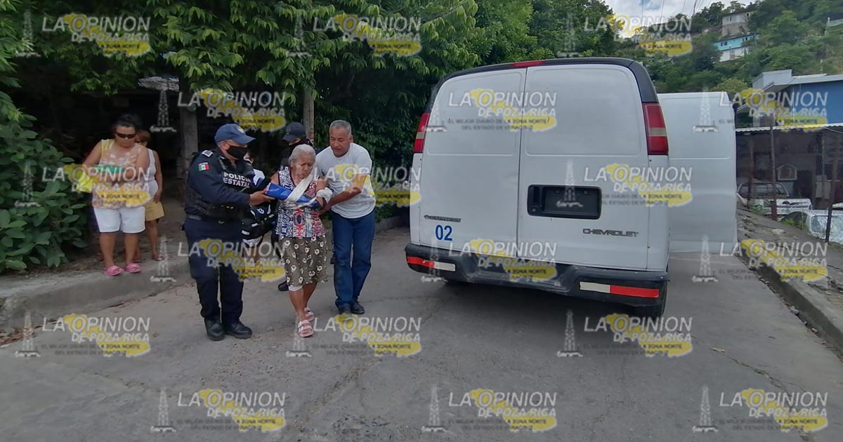 Abuelita se disloca el hombro en caída