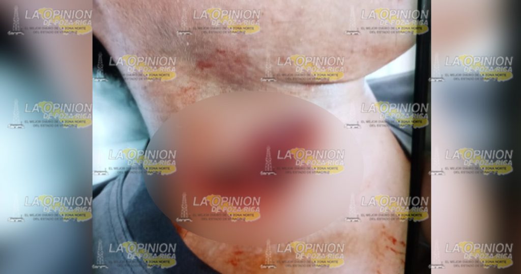 Por poco y matan a adolescente en una riña en Cazones