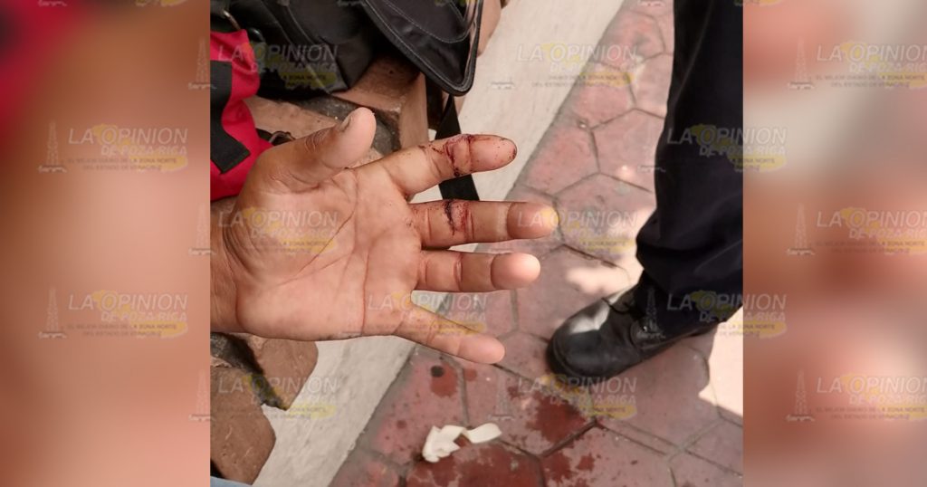 A punto de perder los dedos por un machetazo