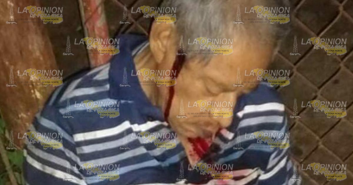 Se pega un tiro en la cabeza