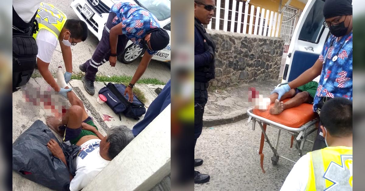 Atropellado por veloz camión de pasajeros