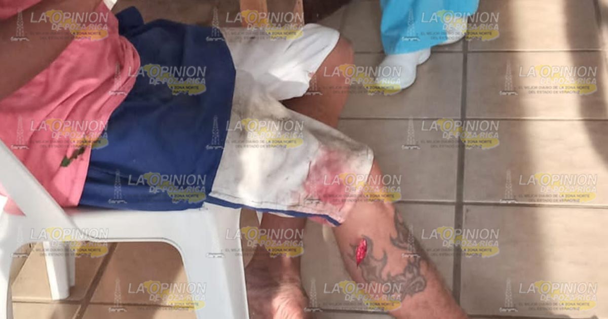 Capturan al caníbal de Cazones, casi le arranca un dedo a policía