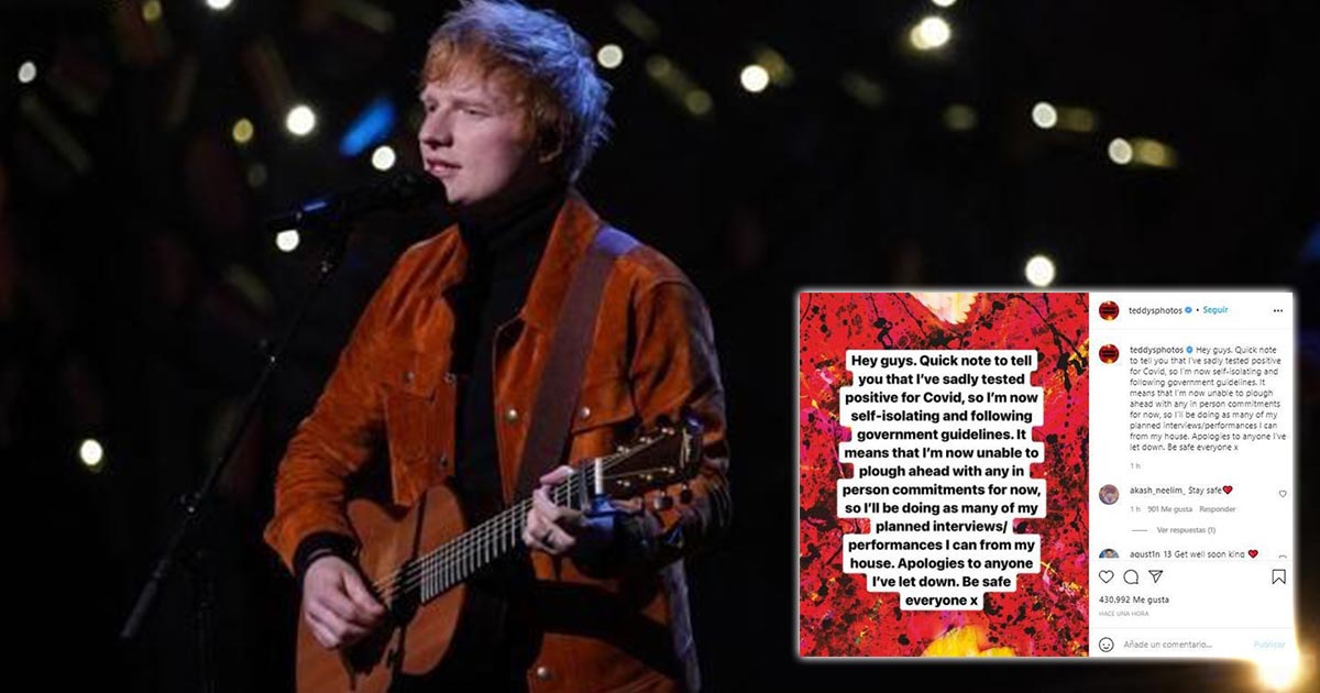 Ed Sheeran da positivo a COVID-19