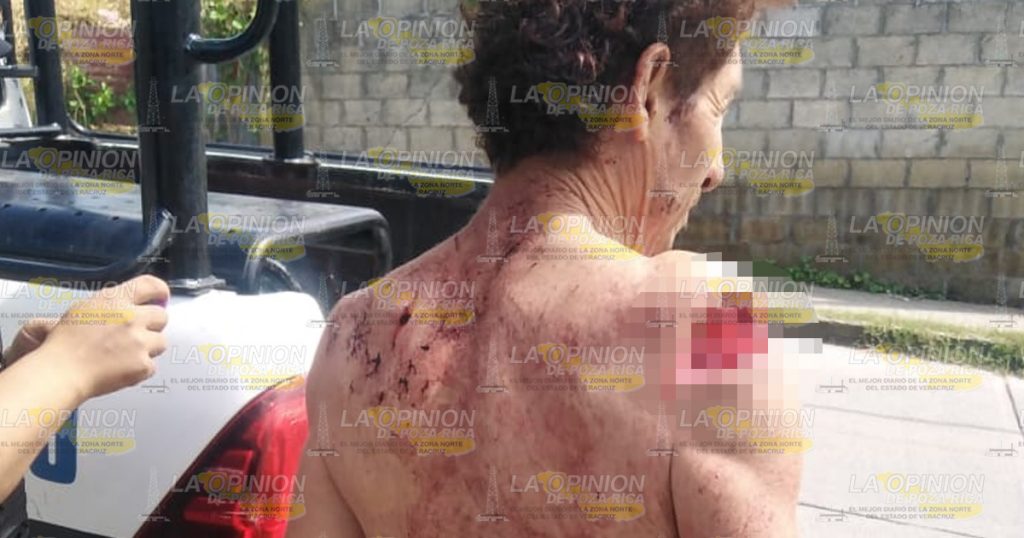 Acuchillado por amigo de parranda