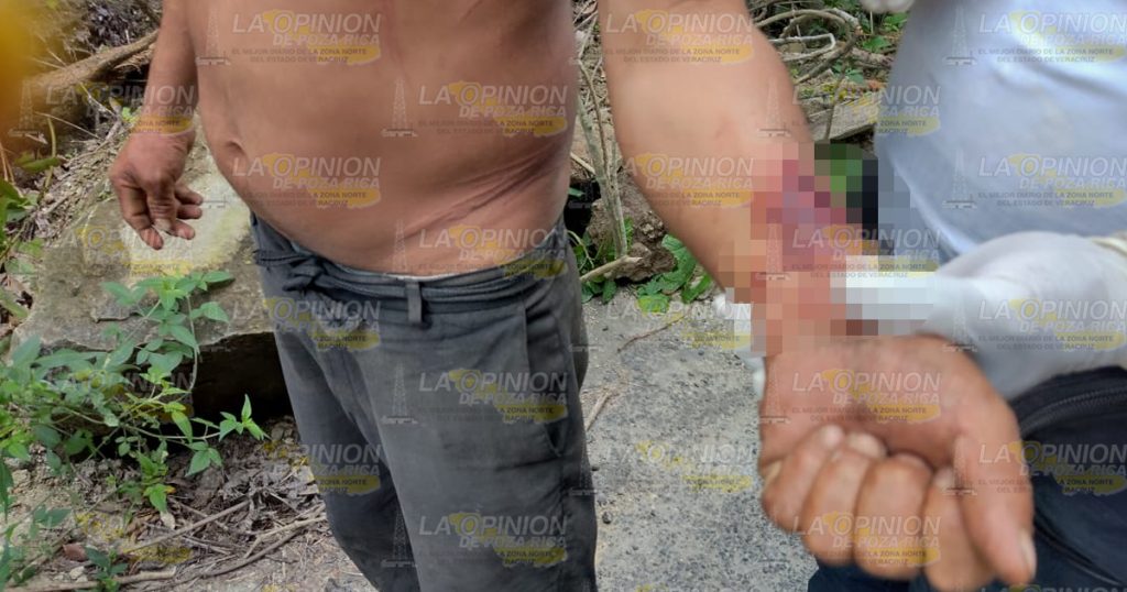 Cayó de lo alto de un cerro