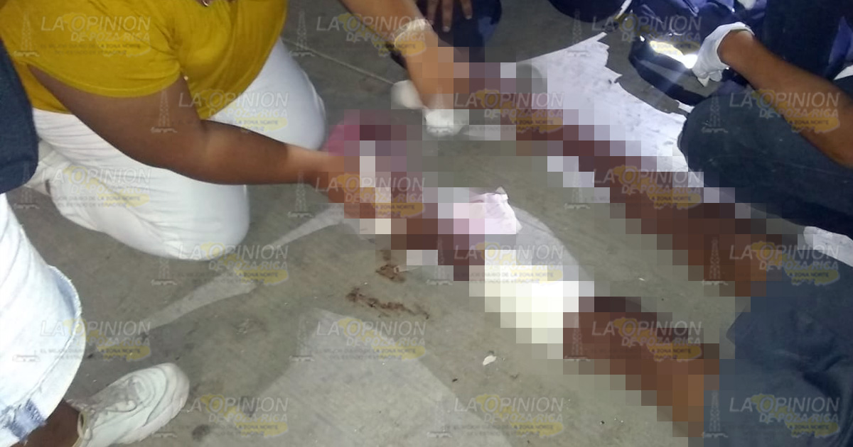 Atropellado queda con heridas expuestas de pies y piernas