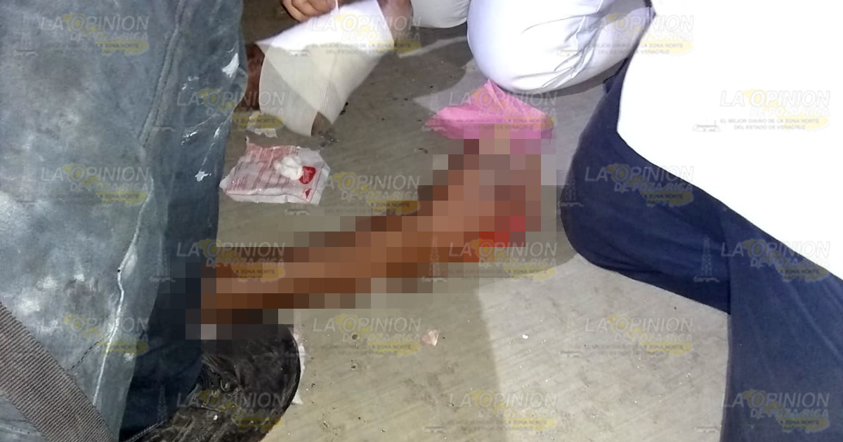 Atropellado queda con heridas expuestas de pies y piernas