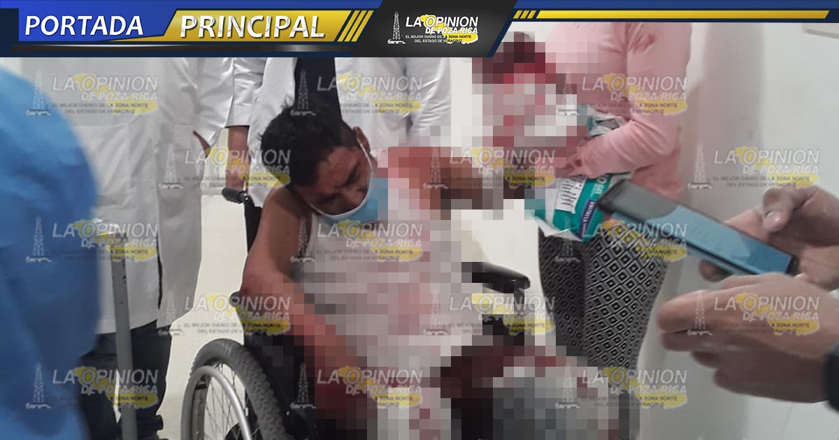 De machetazo le cercenan un brazo