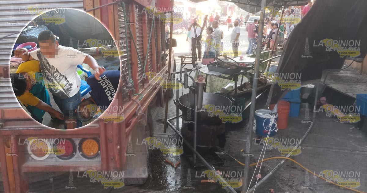 Jovencito se quema con aceite hirviendo