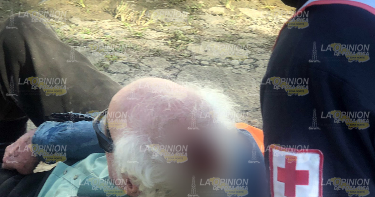 Se abrió la cabeza en caída