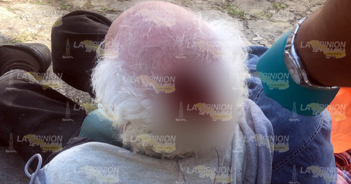 Se abrió la cabeza en caída