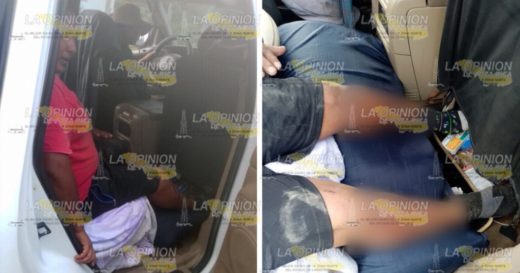 Tractor le prensa las dos piernas