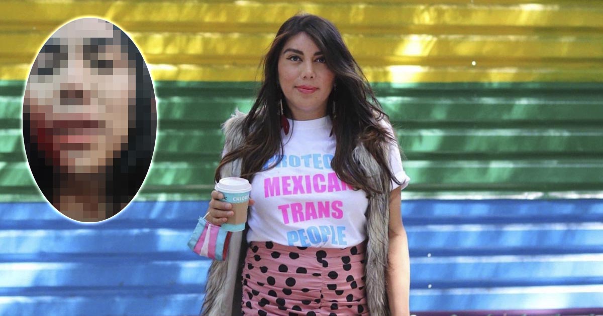 Acuchillan a Natalia Lane, activista trans en CDMX
