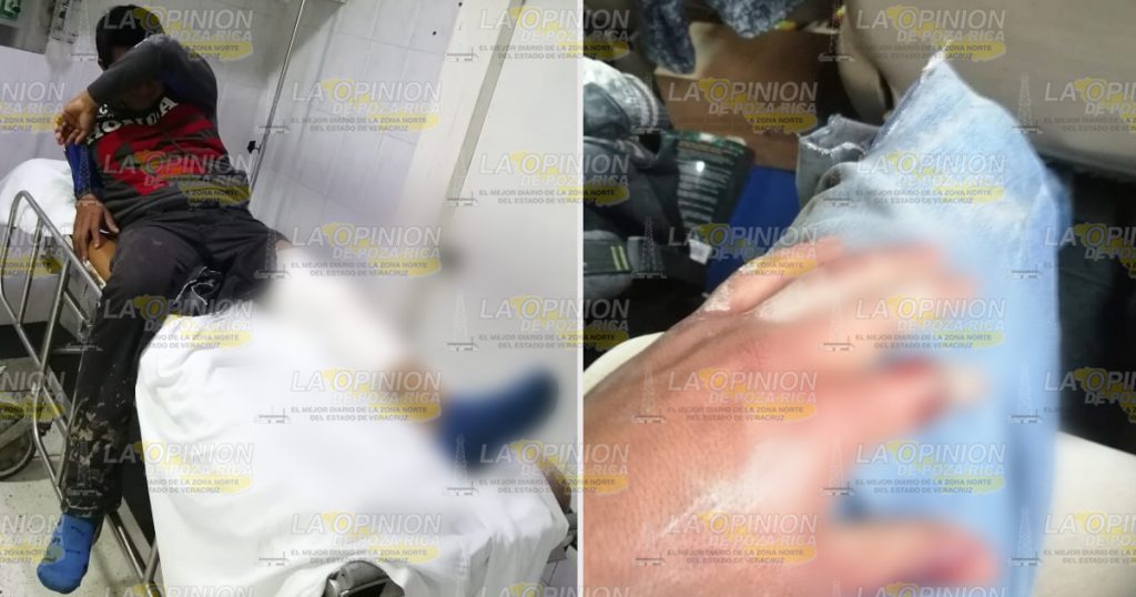 Camión de la SEDENA arrolla a dos motociclistas en Coxquihui