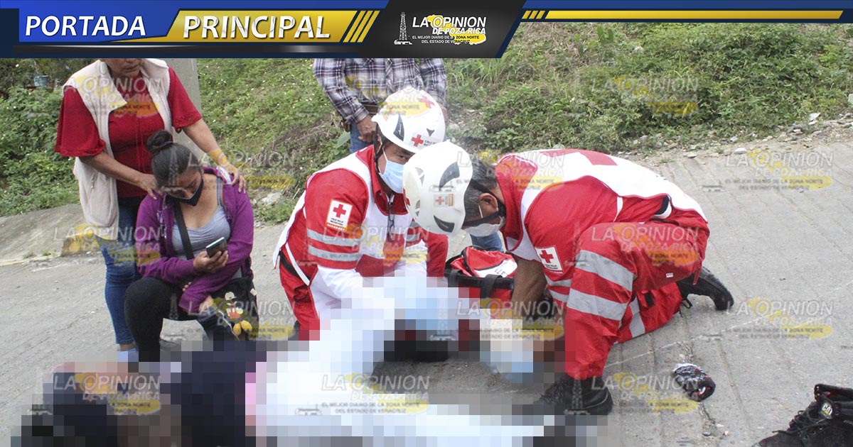 Motociclista sufre fractura expuesta
