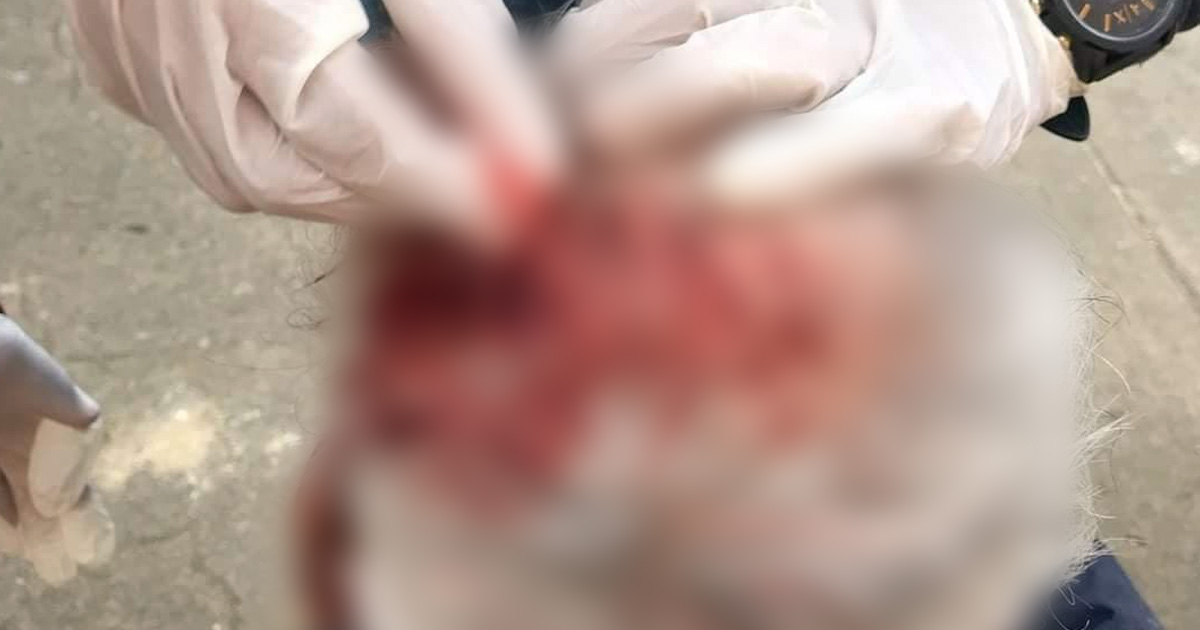 Se abren la cabeza al caer de su propia altura