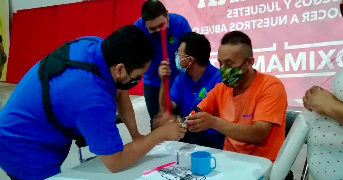 Buscan rotarios personas que necesiten prótesis de mano