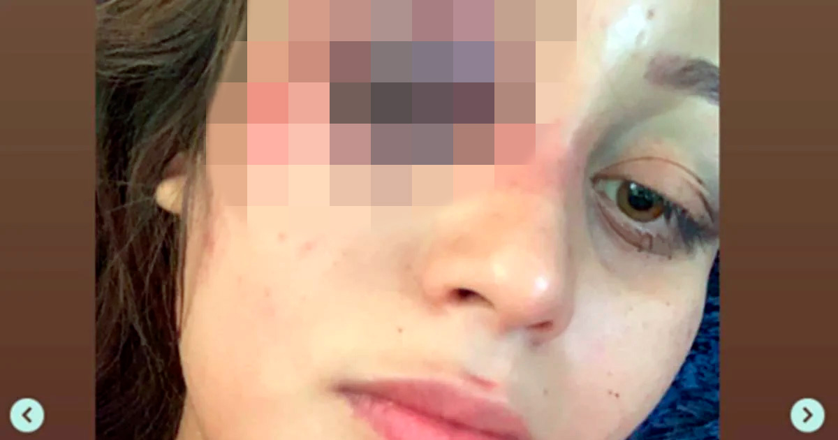 "Si no lograba escaparme, quizás ya no estuviera viva", joven denuncia en redes agresiones de su expareja