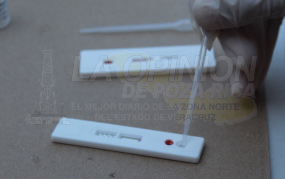 Alertan por más casos de SIDA