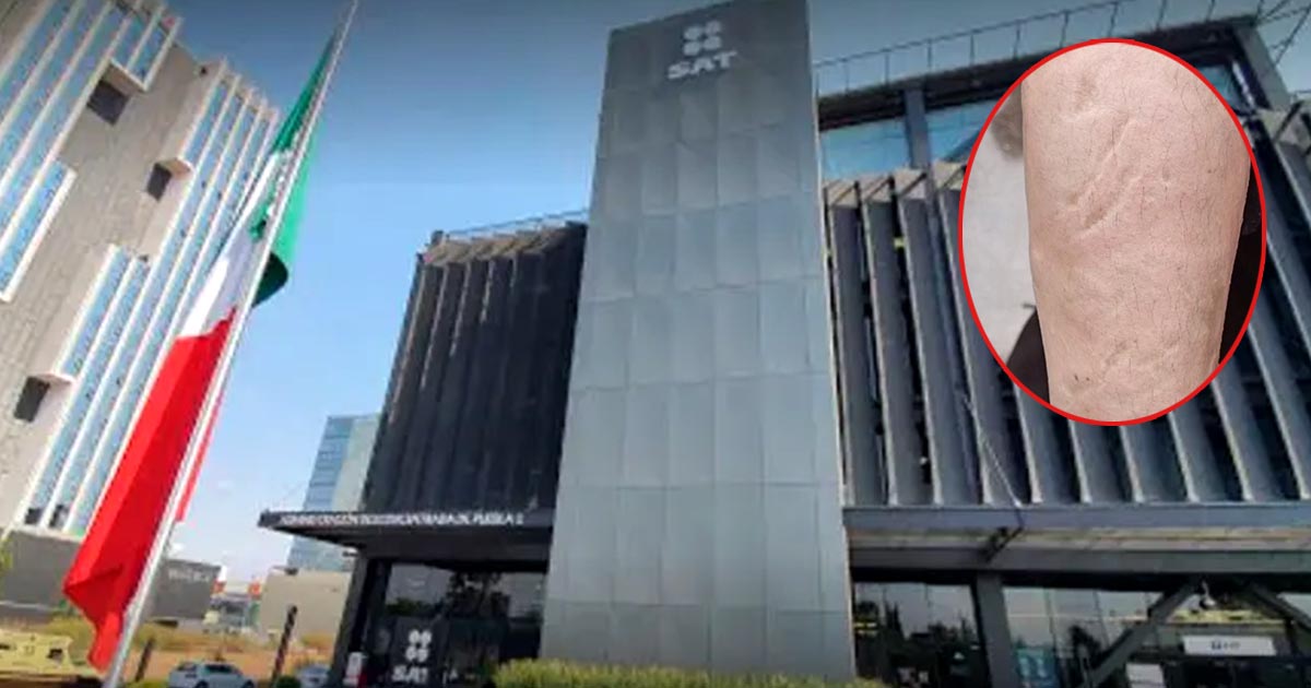 Lanzan ácido a mujer en Puebla