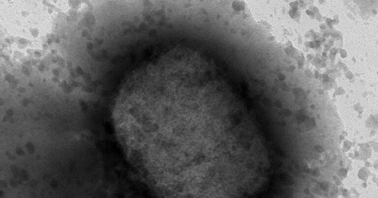 Detectan segundo caso de viruela del mono en México