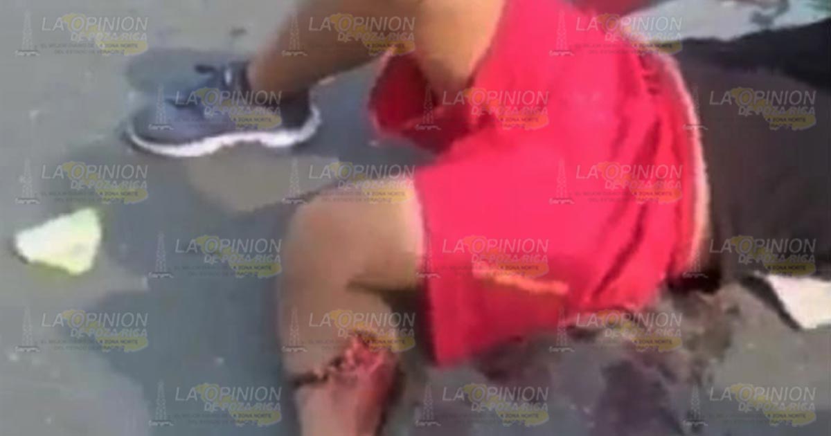 ¡Dos motociclistas lesionados! ¡Dos motociclistas lesionados! 3