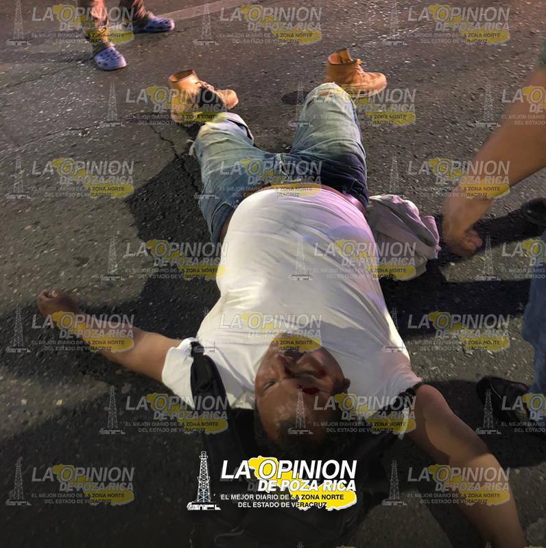 Atropellan ebrio empleado de CAEV Atropellan ebrio empleado de CAEV