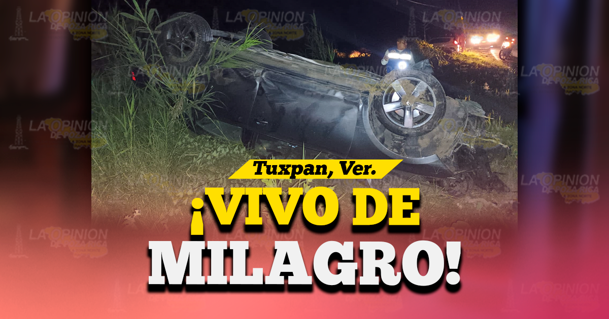 ¡Vivo de milagro! vivo de milagro