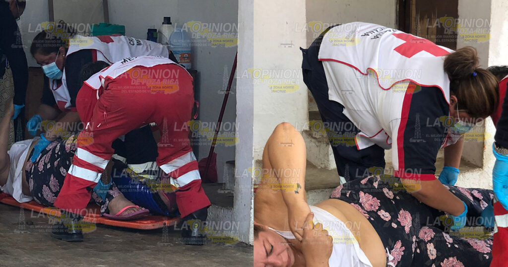 Se fracturó la pierna en caída mientras realizaba limpieza en su domicilio