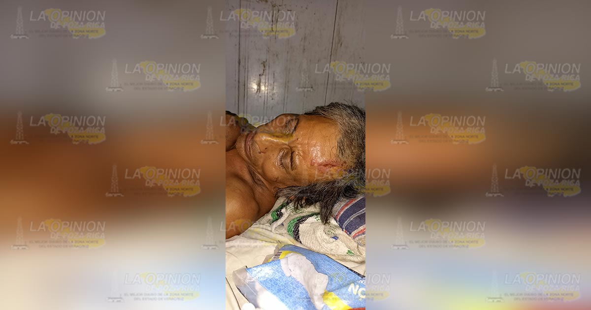 Cae del puente Paso de Cazones y casi pierde la vida