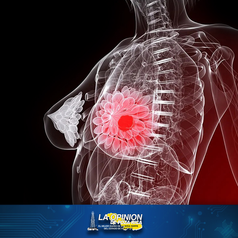Día Internacional de Lucha Contra el Cáncer de Mama