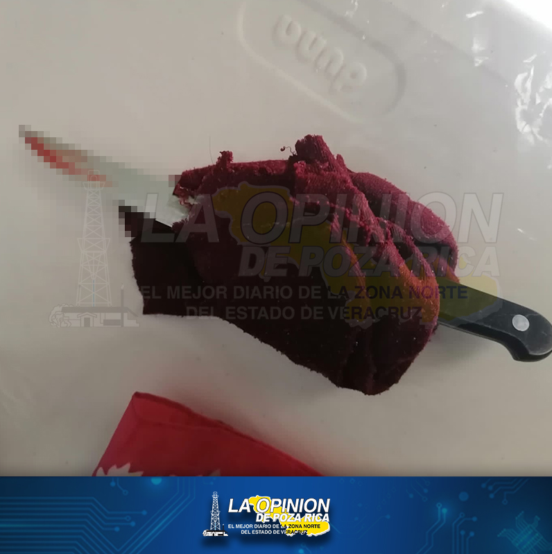 Pareja sentimental lo apuñala