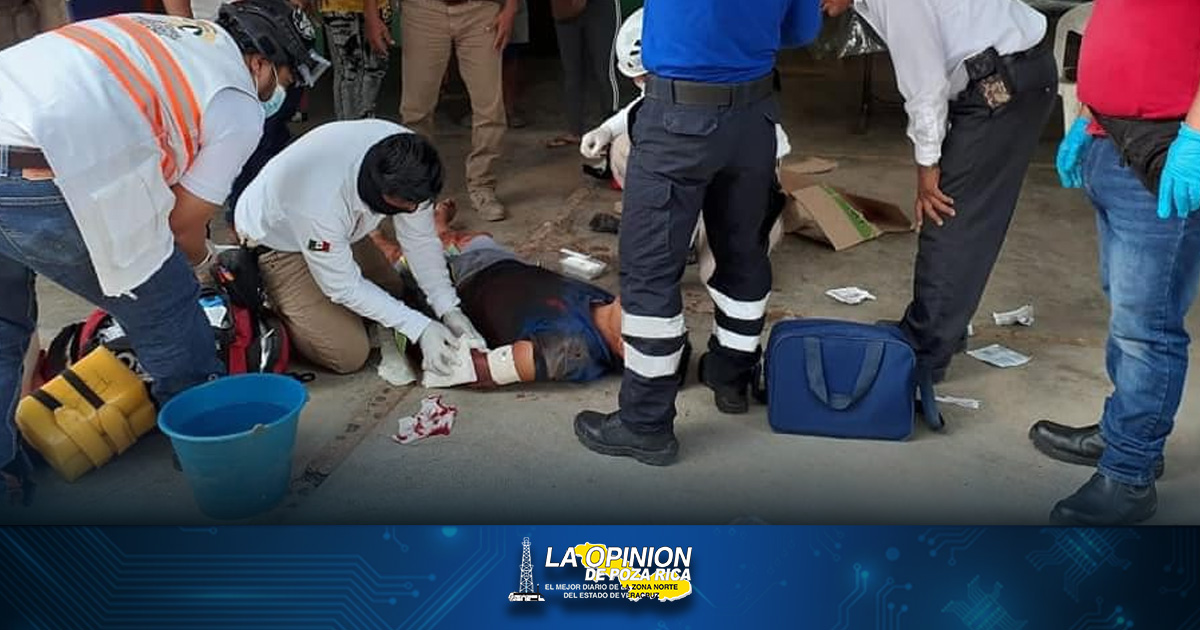 Un pitbull casi le arranca el brazo a un ladrón Un pitbull casi le arranca el brazo a un ladrón