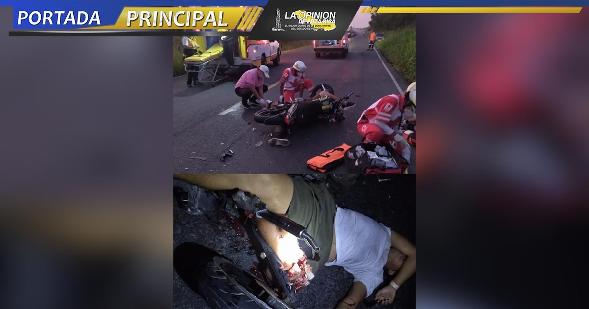 ¡Motociclista pierde pierna!