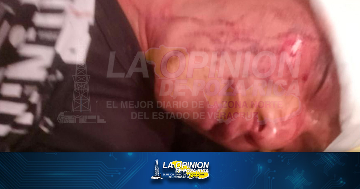 Agrede a golpes Fuerza Civil a joven de la Pantepec