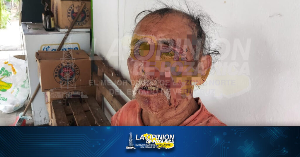 Lo despojaron de sus pertenecías a golpes