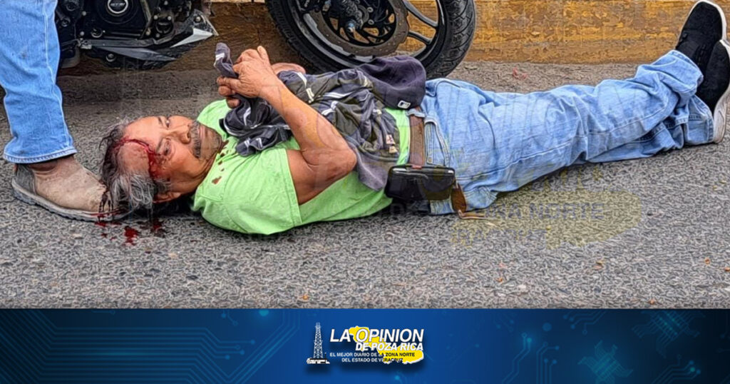 ¡Embestido por un joven motociclista!