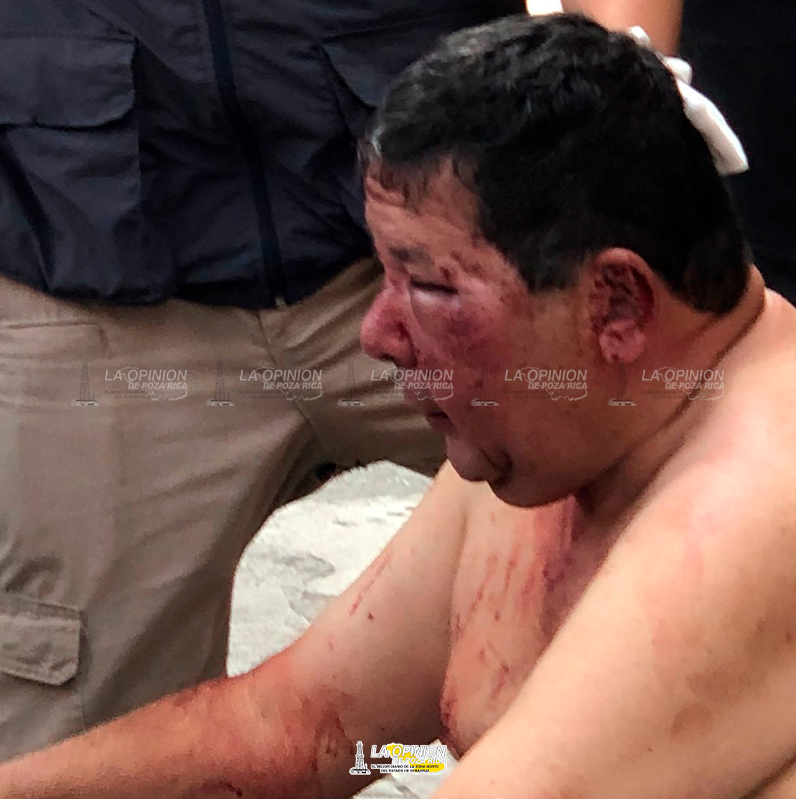 Motoclista lo agredió y dio a la fuga