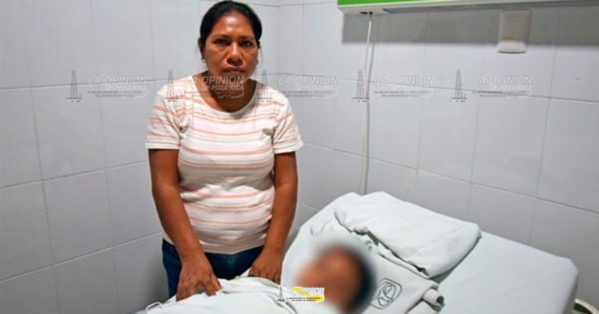 Restauran paladar hendido a paciente pediátrico