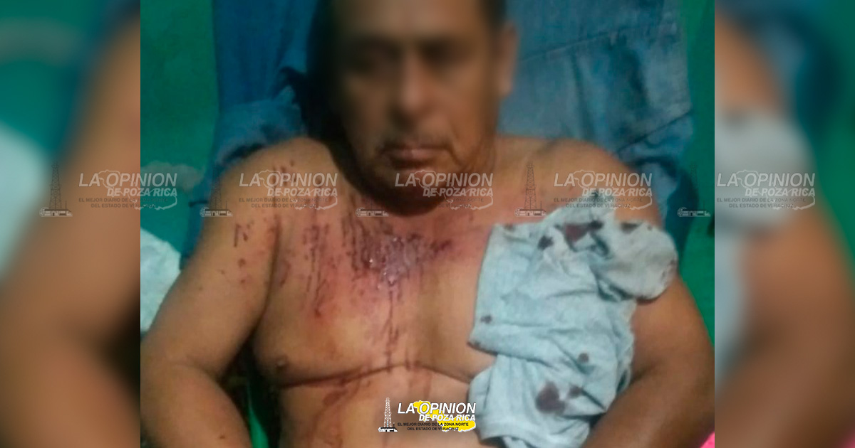 Le meten dos balazos dentro de domicilio