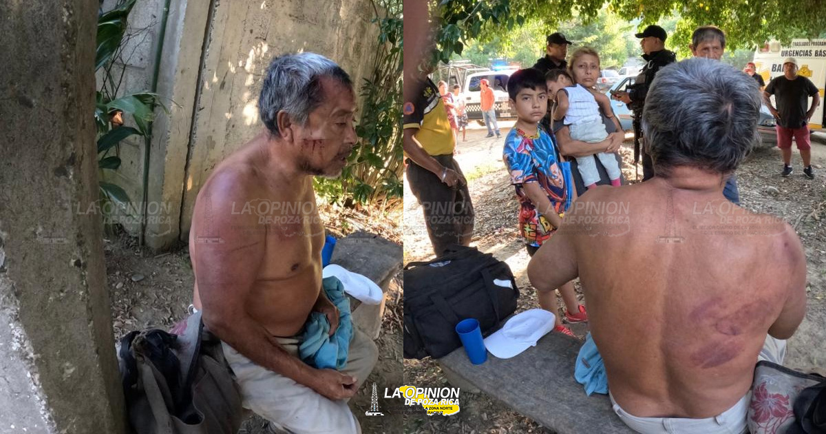 Macheteado por marihuano en Tihuatlán