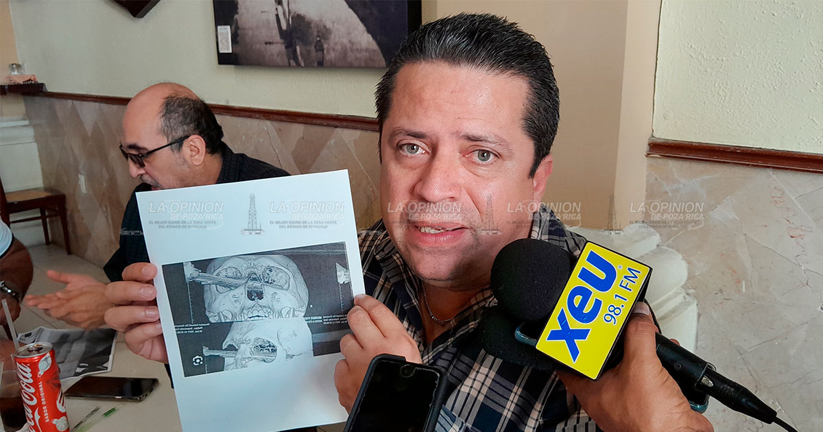 Buscan pena máxima para quien agredió en el ojo a sujeto en Centro Comercial de Veracruz
