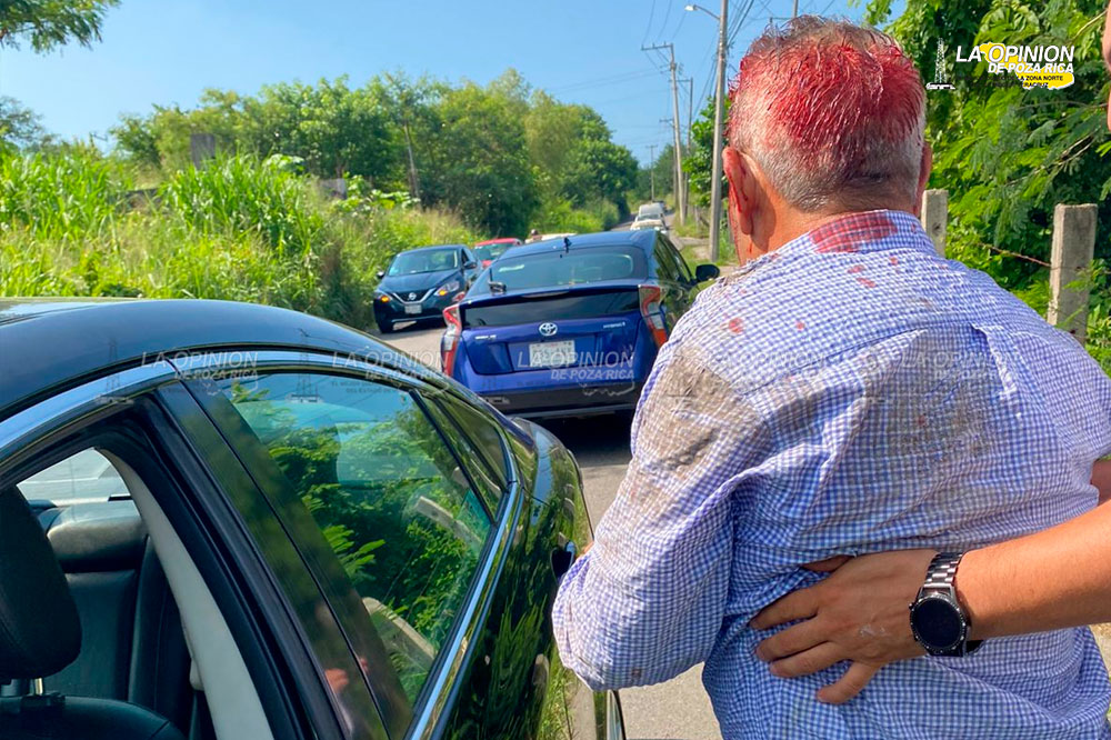 ¡Casi pierde la vida!