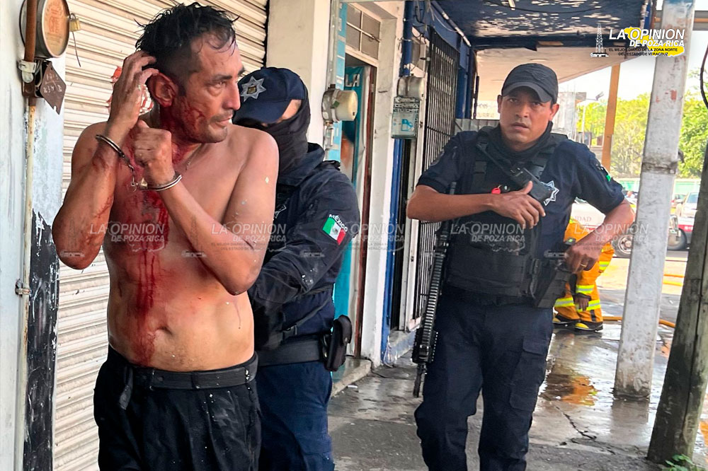 Incendió su vivienda, frente a la Plaza Cívica