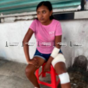 Pareja de motociclistas atropellados frente al DIF Coatzintla